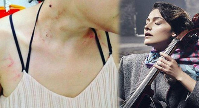 'Müzisyen kadına dayak' iddiasıyla ilgili Emniyet'ten açıklama