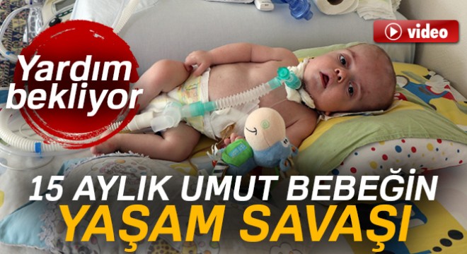 15 aylık Umut bebek yardım bekliyor