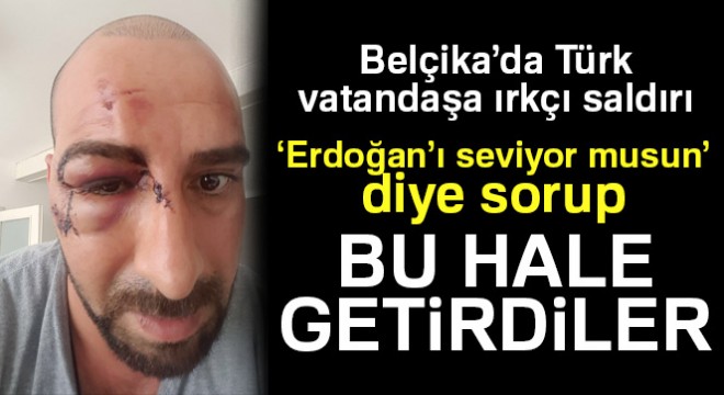 Belçika'da ırkçılar Türk vatandaşını 'Erdoğancı' diye darp etti