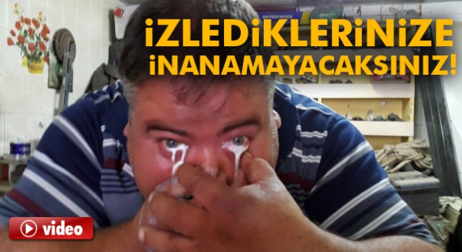 Burnundan aldığı sütü gözünden fışkırtan adam şaşırtıyor