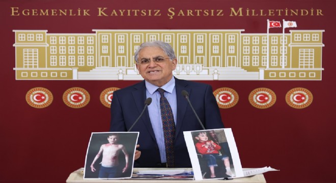 CHP ANKARA MİLLETVEKİLİ ÜNSAL'IN BASIN TOPLANTISI