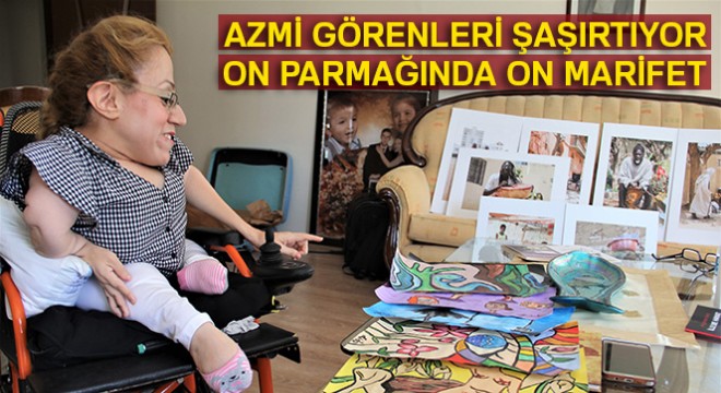 Cam kemik hastası kadının on parmağında on marifet