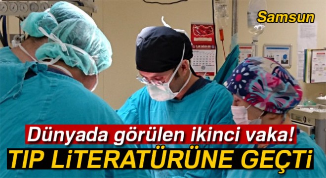 Dünyada ikinci kez rastlanan vaka doktorları bile şaşırttı