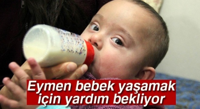 Eymen bebek yaşamak için yardım bekliyor