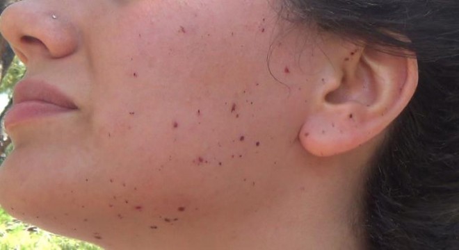 Mezuniyet kabusu!.. 9 kişi yaralandı