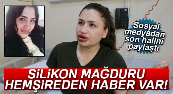Silikon mağduru hemşirenin son hali