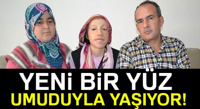 Yeni bir yüz umuduyla yaşıyor!